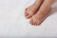 Possible Causes of Hammertoe