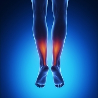 Stages of an Achilles Tendon Injury